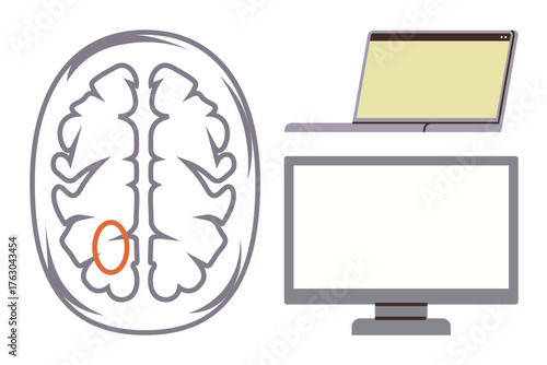 Brain with marked region, laptop, and monitor linking neuroscience, research, and data analysis. Ideal for education, AI, healthcare neurology tech innovation mental health science. Simple flat