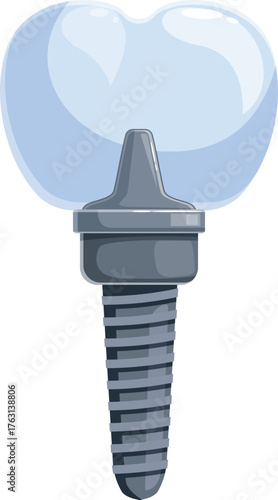 Modern dental implant seamlessly integrates with a natural looking tooth crown, providing a durable and aesthetically pleasing solution for missing teeth