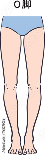 若い女性の脚（O脚）