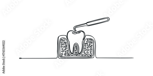 Dental anatomy tooth root with instrument line drawing