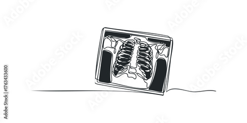 Single line drawing of a medical X-ray of lungs