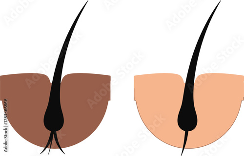 Understanding split ends causes prevention and treatment guide