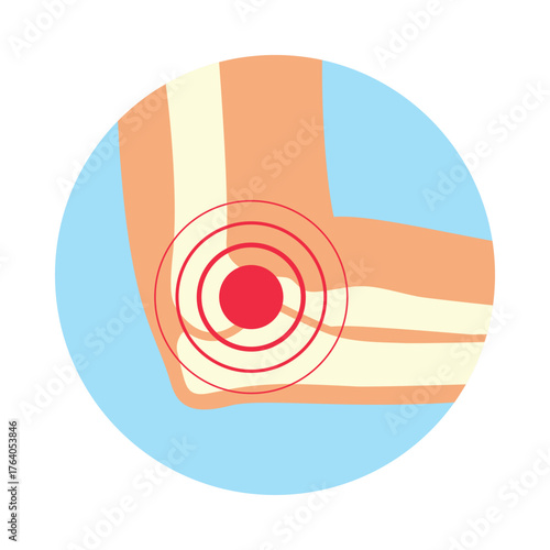 An icon of elbow arthritis or arthrosis, with emphasis on the painful symptoms, presented in a simple, colorful design suitable for educational purposes.