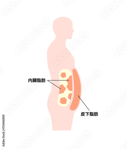 肥満体型の腹部イラスト / 内臓脂肪と皮下脂肪
