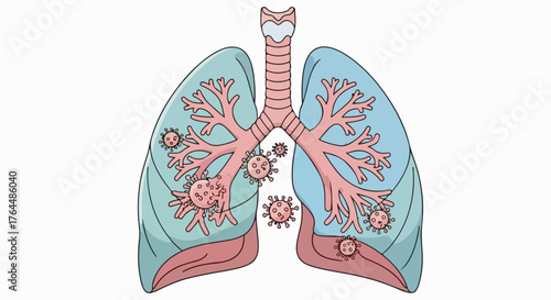 illustration of human lungs with virus particles attacking respiratory tracts