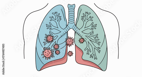 illustration of human lungs with virus particles attacking respiratory tracts