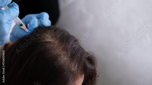 Doctor is doing a plasma therapy injecting head for healthy hair growth. Professional medical worker uses small syringe needle for injections plasma therapy close-up