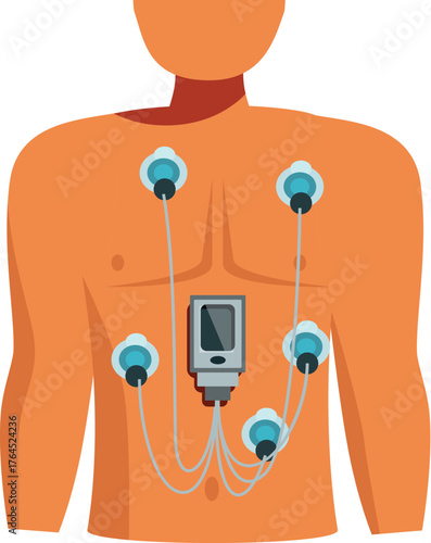 Electrocardiogram procedure using a holter monitor for continuous heart rate monitoring and diagnosis