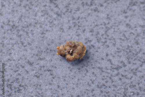 Oxalate stone. Medicine, urology. Macro photo of a kidney stone. Renal colic. 5 mm oxalate stone. Kidney health. Urology, visual aid.