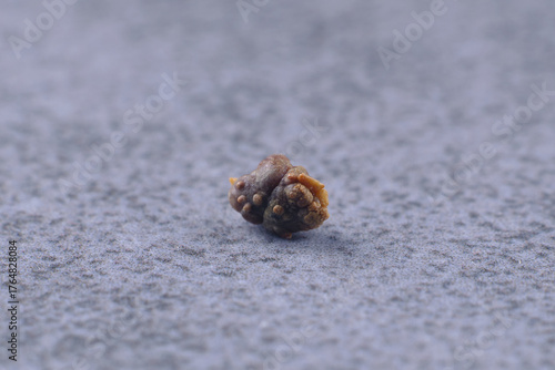 Oxalate stone. Medicine, urology. Macro photo of a kidney stone. Renal colic. 5 mm oxalate stone. Kidney health. Urology, visual aid.