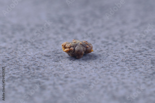 Oxalate stone. Medicine, urology. Macro photo of a kidney stone. Renal colic. 5 mm oxalate stone. Kidney health. Urology, visual aid.