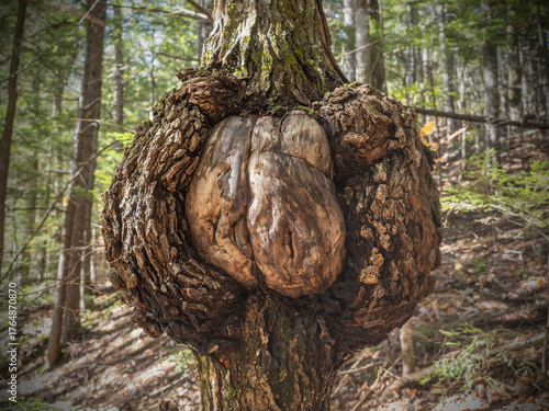 A burl is a large woody, rounded swelling growth usually found on a tree trunk. 
