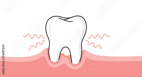 Toothache Illustration - Aching Tooth in Gum.