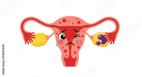 Sad Uterus Cartoon Illustration of Female Reproductive Health.