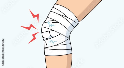 Cartoon Knee Injury with Bandage Wrap Indicating Pain and Medical Condition on Light Blue Background, Illustration for Healthcare Website Presentation, First Aid Guide, Physical Therapy, Sports, Ortho