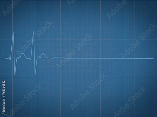 Dramatic electrocardiogram flatline on a blue grid background evokes a sense of critical health emergency or vital signs monitoring