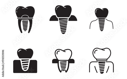 Dental Implant Diagram Set for Oral Health and Dentistry Concepts Illustrating Tooth Replacement and Restoration Procedures