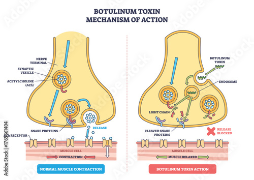 Botulinum toxin mechanism illustration shows a nerve terminal blocking acetylcholine release, key objects, synaptic vesicles, SNARE proteins, ACh receptor. Outline diagram