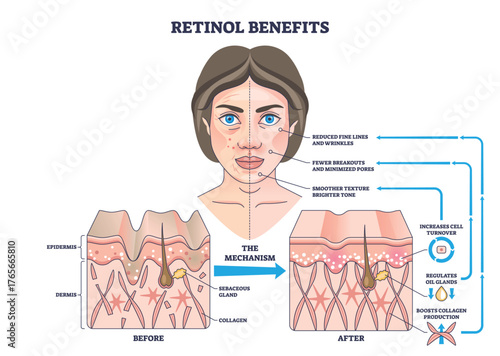 Retinol benefits outline showing how retinol boosts collagen and cell turnover, woman s face, skin cross-sections before-after, and arrows explain clearer texture and fewer wrinkles. Outline diagram