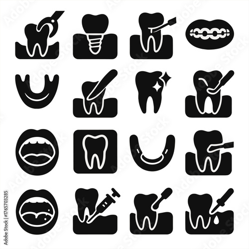 Dental Procedure Icons. Mouth medical and dental procedures icons in silhouette. Tooth extraction, dental implant, root canal, braces, mouth guard