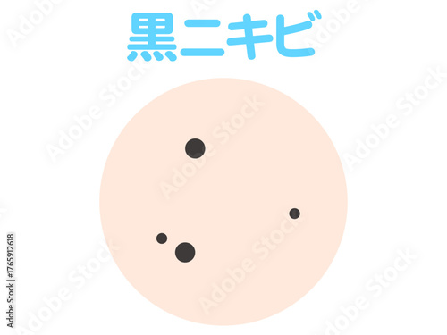 シンプルな黒ニキビのイラスト素材