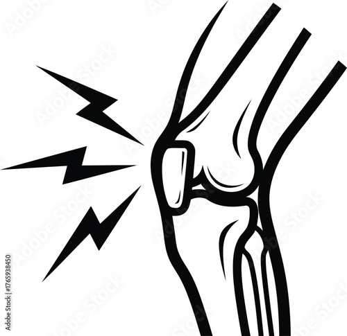 Illustration of a painful knee joint with lightning bolts indicating pain