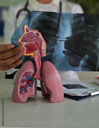 3d model of respiratory system and x-ray examination in medical