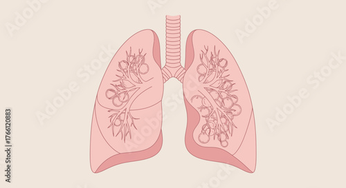 Detailed illustration of human lungs with bronchi and alveoli.