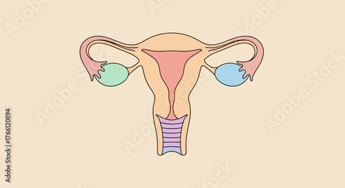 Anatomical illustration of the female reproductive system including uterus ovaries and fallopian tubes.