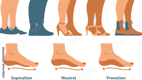 Foot Pronation and Supination Explained with Footwear Examples Flat Shoes, Heels, and Boots Guide