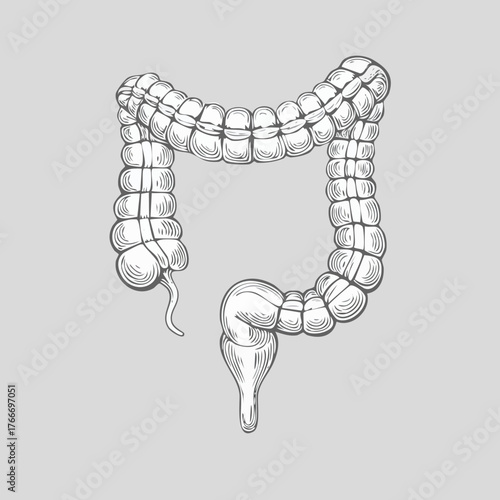 Detailed anatomical illustration of the human colon, digestive system.