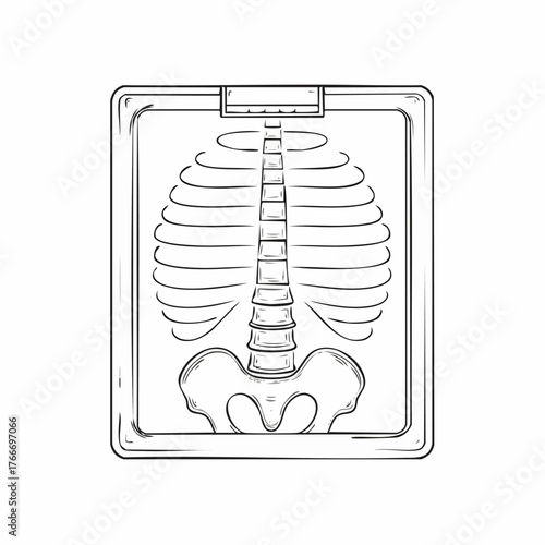 X-ray image of human spine and rib cage for medical analysis.