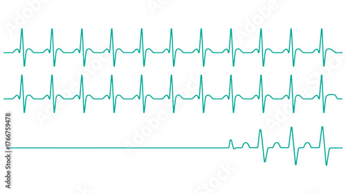 Heartbeat EKG Monitor Waveform Medical Line Illustration