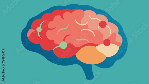 A 3D model of the brain revealing areas of significant brain atrophy a result of chronic inflammatory conditions such as rheumatoid arthritis.. Vector illustration