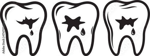Three cartoon teeth with cavities and dripping decay