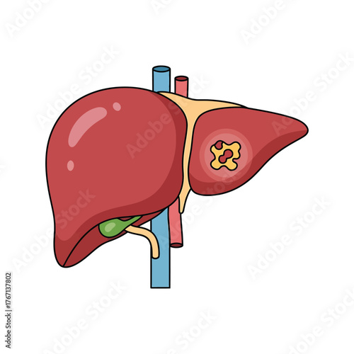 Understanding liver anatomy and diseases using this detailed medical illustration