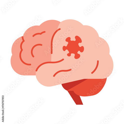 Brain with tumor symbolizes neurological disease, medical condition research need