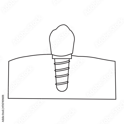 Dental Implant Structure line icon