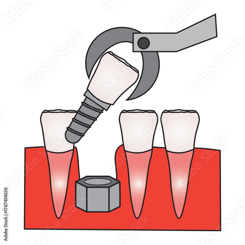 Incisor Tooth Replacement and Oral Health Illustration