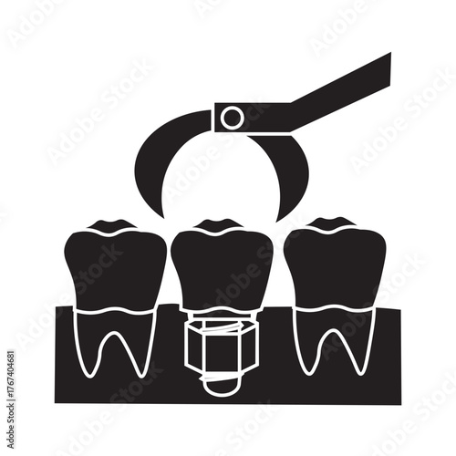 Molar Dental Implant Installation glyph icon