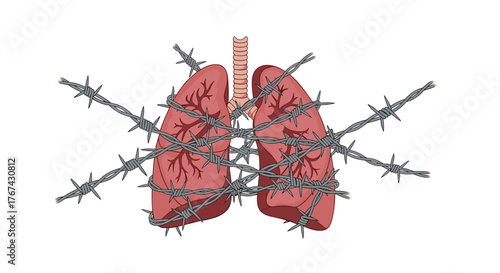 Illustration of lungs entangled with barbed wire, symbolizing respiratory illness or restricted breathing.