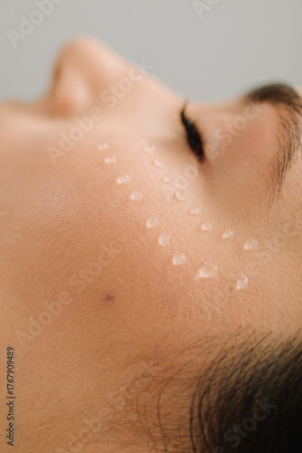 Φωτογραφία Facial mesotherapy to rejuvenate skin and improve skin health and appearance