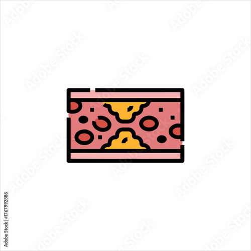 Artery showing plaque buildup and reduced blood flow, representing atherosclerosis and cardiovascular disease, highlighting health concerns and medical conditions.