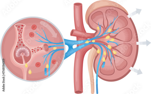 Anatomical illustration of a kidney showing its internal structure and the process of filtration with a zoomed-in view.