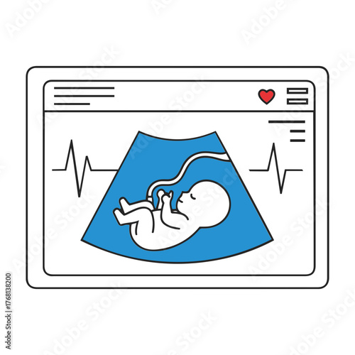 Vector illustration of a fetal ultrasound showing a baby inside the womb on a screen display