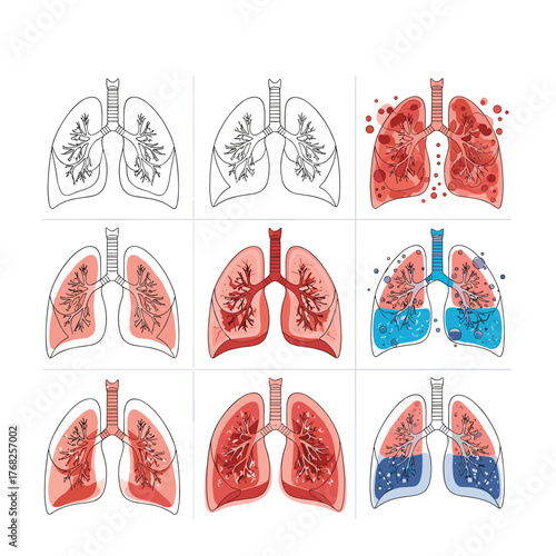 A collection of nine medical illustrations showcasing the human lungs in various states, from healthy outlines to conditions like pneumonia and fluid accumulation.