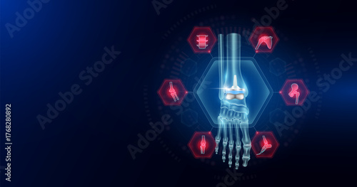 Ankle joint replacement partial surrounded by arthritis icons. Artificial joint surgery, prosthetic implant integrated into the foot bone. Orthopedic technology medical. Empty space for text. Vector.