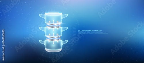 Disc replacement. Prosthetic implant integrated into the spinal bone. Orthopedic technology artificial joint surgery in a transparent anatomical. Medical health care vector.