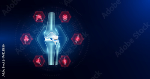 Knee joint replacement partial surrounded by arthritis icons. Artificial joint surgery, prosthetic implant integrated into the leg bone. Orthopedic technology medical. Empty space for text. Vector.