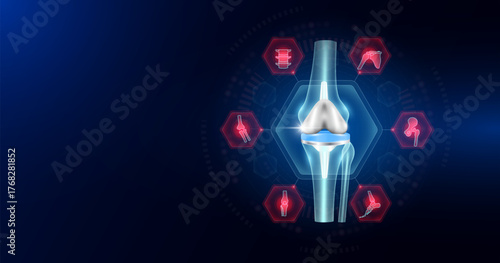 Knee joint replacement partial surrounded by arthritis icons. Artificial joint surgery, prosthetic implant integrated into the leg bone. Orthopedic technology medical. Empty space for text. Vector.